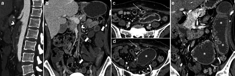 Fig. 11