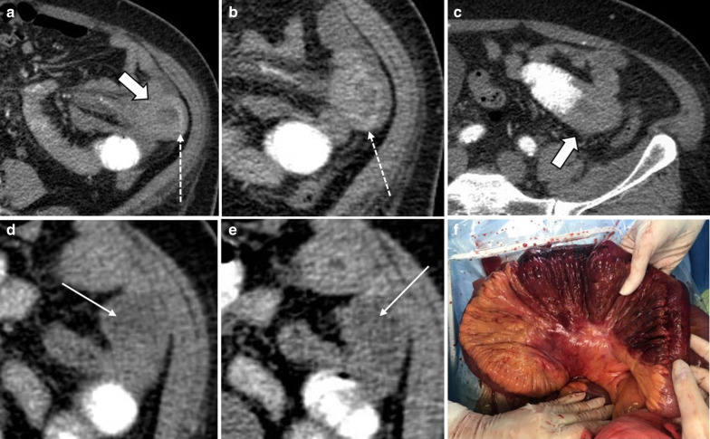 Fig. 24