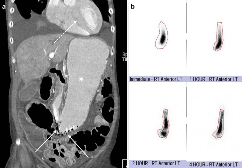 Fig. 28