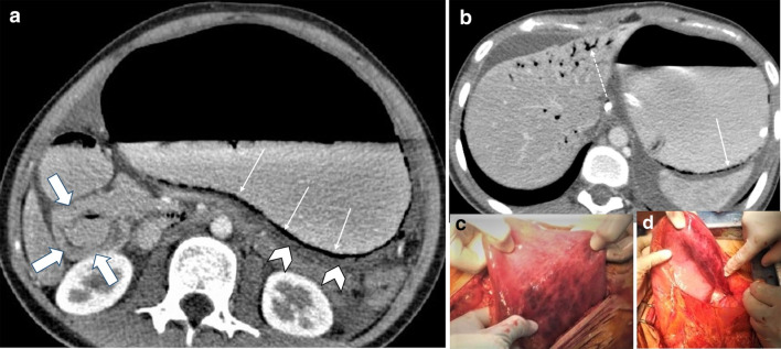 Fig. 21