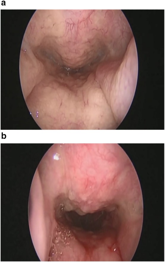 Fig. 4