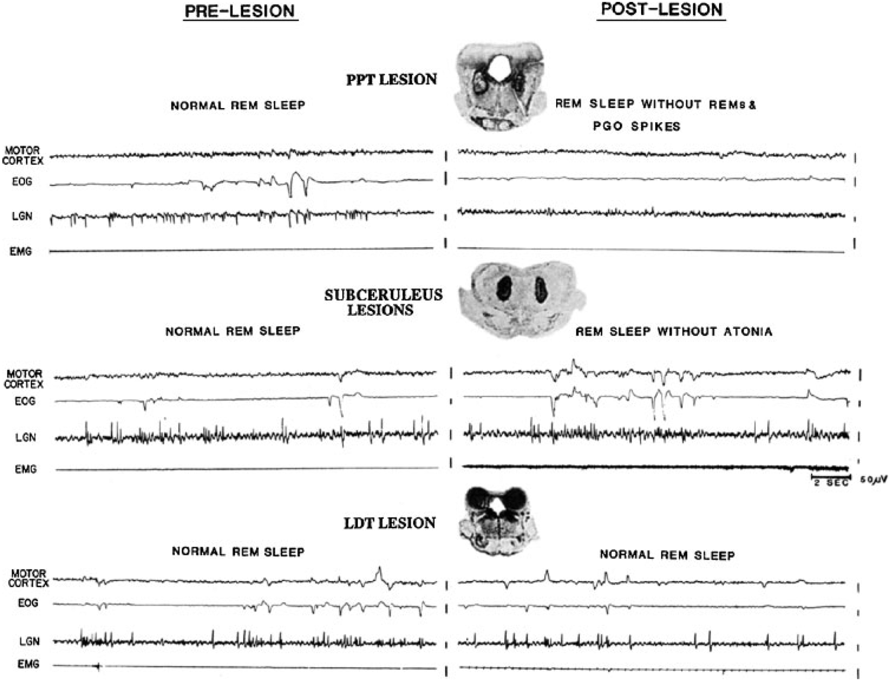 The Neurobiology of Sleep - PMC