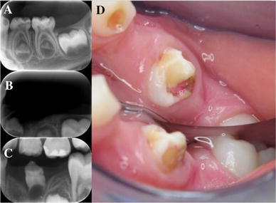 Fig. 1