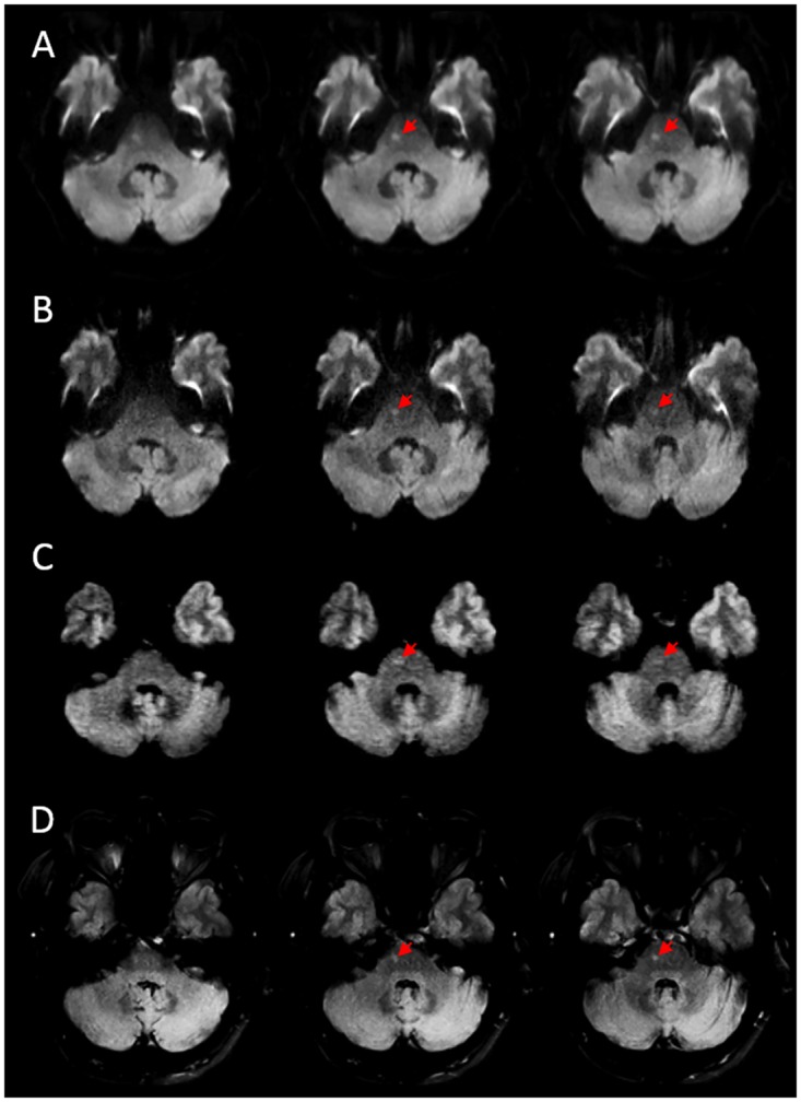 Fig 4