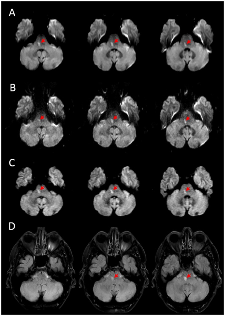 Fig 3