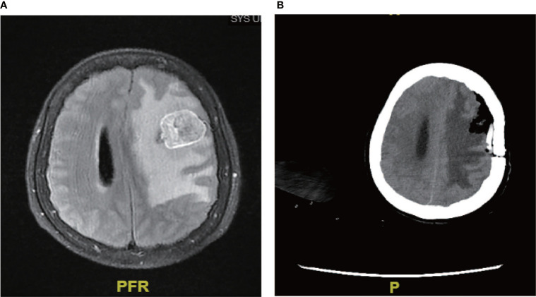 Figure 3