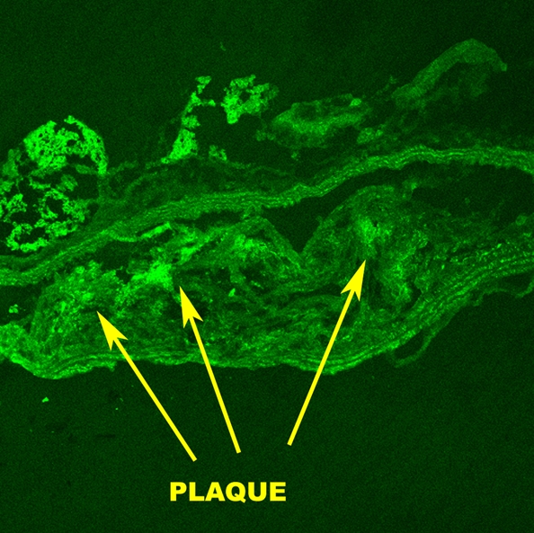 Figure 4b: