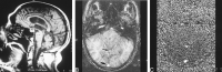 <sc>fig</sc> 1.