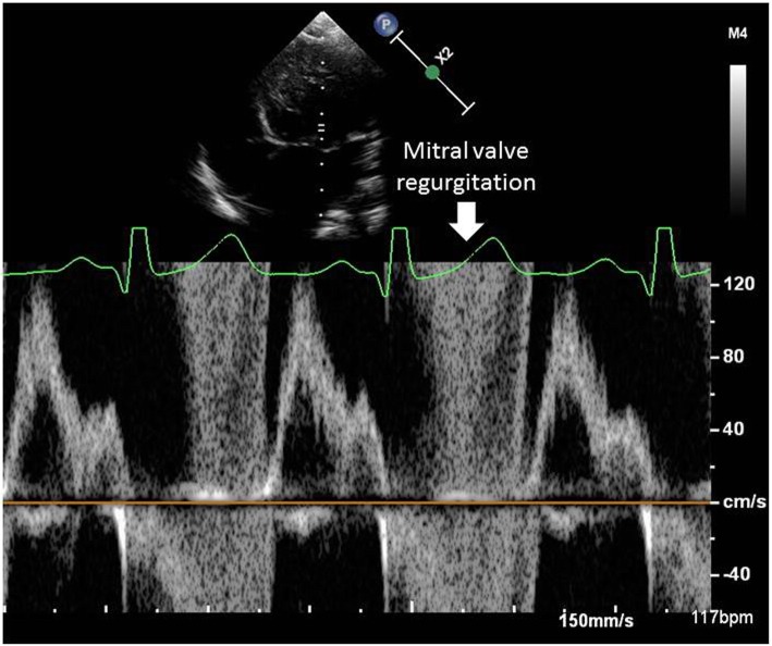 Fig. 3