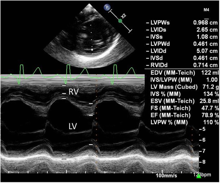 Fig. 2