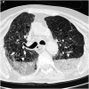 Fig. 5