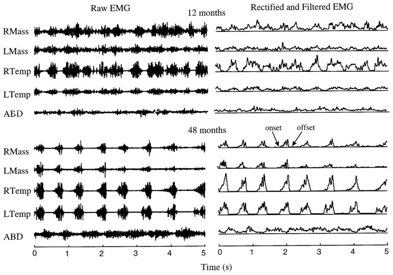 FIG. 1