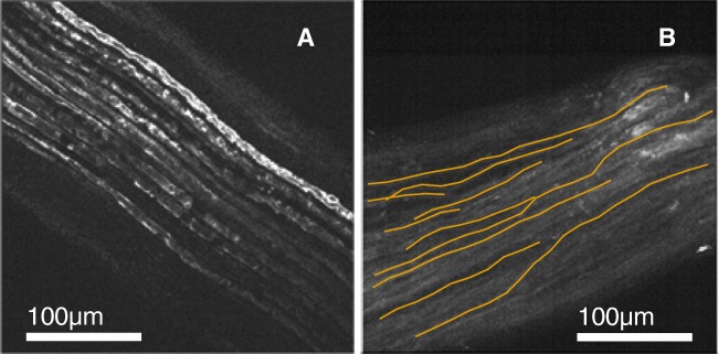 Fig. 13