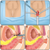 Figure 6