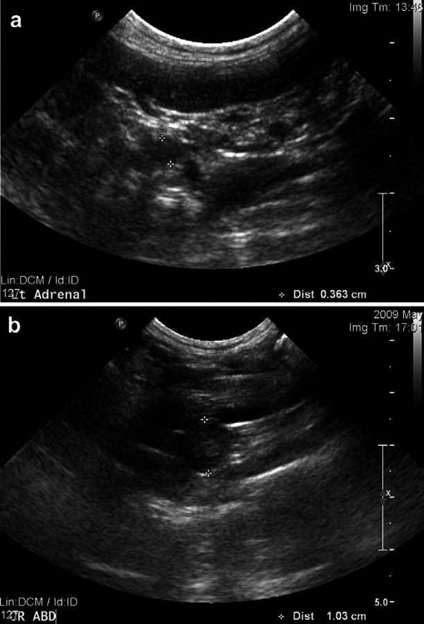 Fig 1.