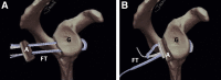Fig 13