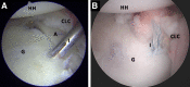 Fig 12