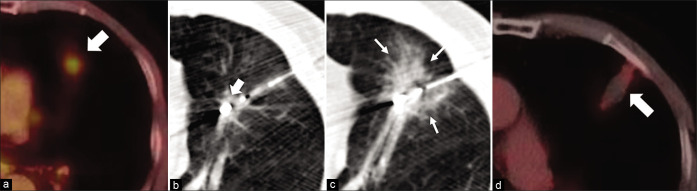 Figure 1: