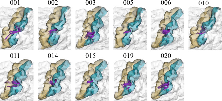 Fig. 11