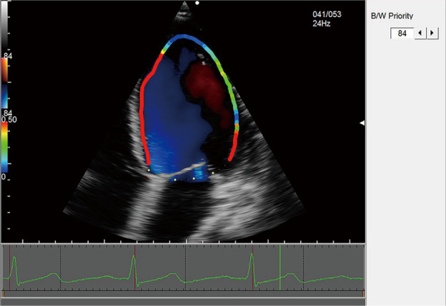 Figure 4