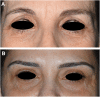 <b>FIG. 1.</b>