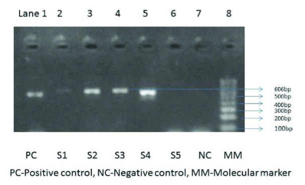 [Table/Fig-4]: