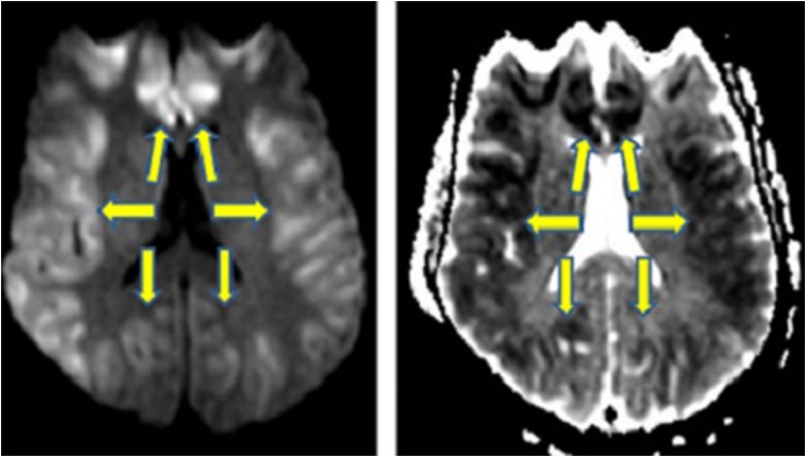 Fig. 9