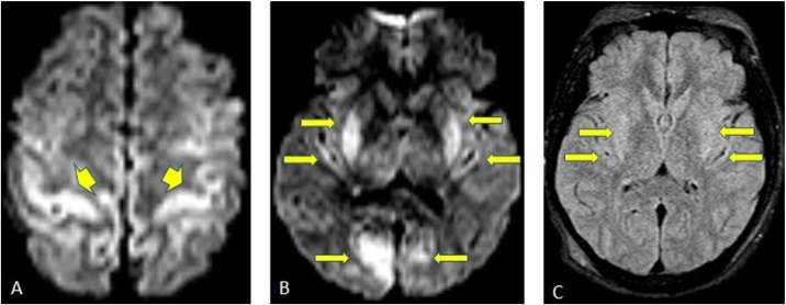 Fig. 8