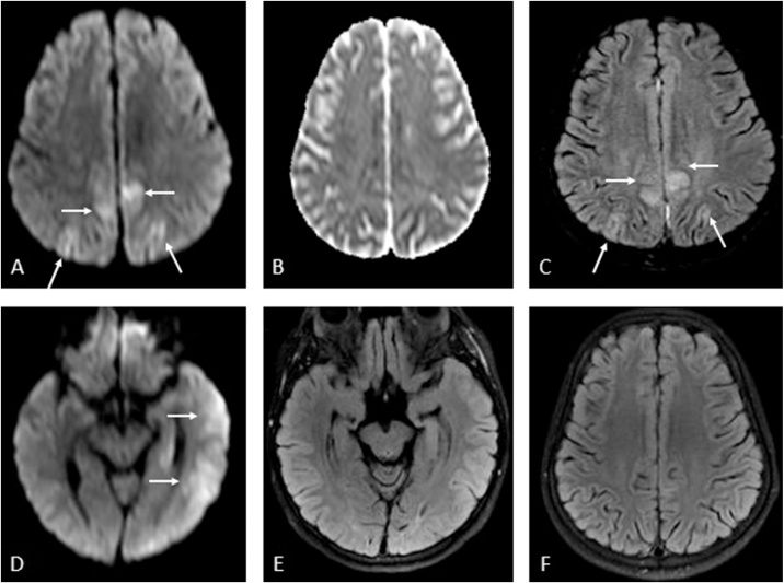 Fig. 7