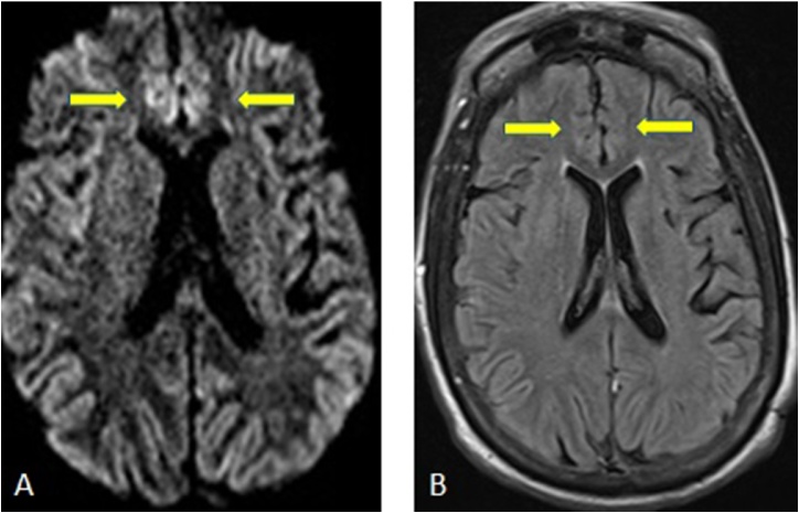 Fig. 11