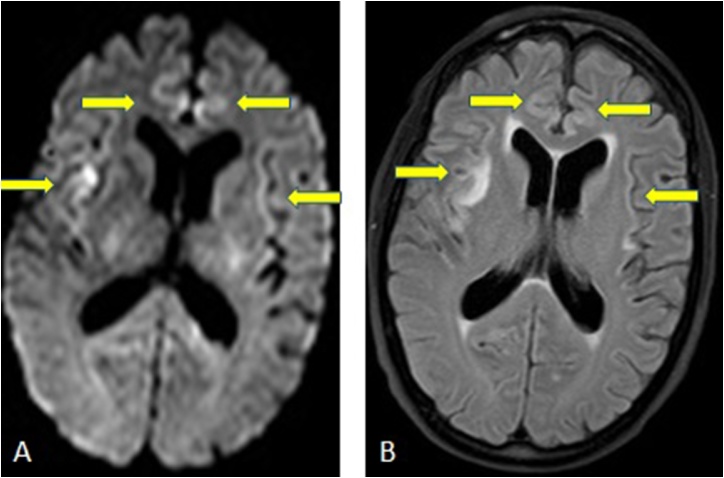 Fig. 10