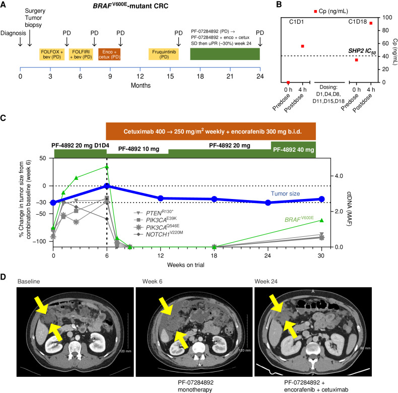 Figure 3. PF-07284892 overcomes intrinsic resistance to encorafenib + cetuximab in a BRAFV600E-mutant CRC patient. A, The patient's previous systemic therapies were chemotherapy + bevacizumab, encorafenib + cetuximab, and fruquintinib, with the best overall response PD, indicating primary progression/intrinsic resistance to each therapy. B, Levels of PF-07284892 (red squares) in plasma, as in Fig. 2D; blood samples for pERK were not available. C, Change in the sum of the longest tumor diameters of target lesions and in BRAFV600E (and other mutations) in ctDNA over time, as in Fig. 2E. D, Imaging of a right-sided intra-abdominal target lesion mass during study treatment. The patient experienced one AE with monotherapy (grade 2 ascites not related to study treatment) and three grade 1 AEs with combination treatment (headache, fatigue, and acneiform rash, the latter a known toxicity of cetuximab). bev, bevacizumab; b.i.d., twice daily; C, cycle; cetux, cetuximab; Cp, plasma concentration; CRC, colorectal cancer; D, day; enco, encorafenib; FOLFIRI, folinic acid, fluorouracil, irinotecan; FOLFOX, folinic acid, fluorouracil, oxaliplatin; MAF, mean allele frequency; PD, progressive disease; PF-4892, PF-07284892; SD, stable disease; uPR, unconfirmed partial response.