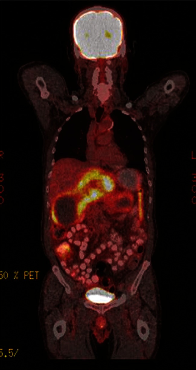 Fig. 4