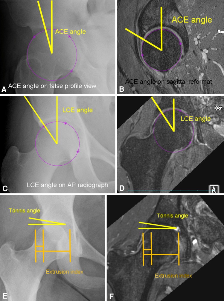 Fig. 2A–F