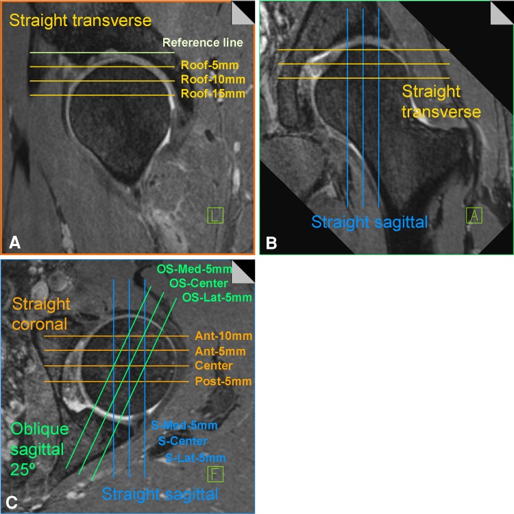 Fig. 1A–C