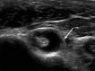 Figure 22
