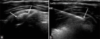 Figure 25