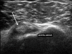 Figure 23