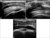 Figure 18