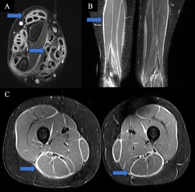 Fig. 2