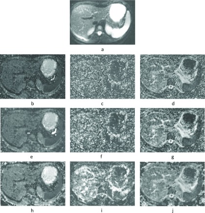 FIG. 4.