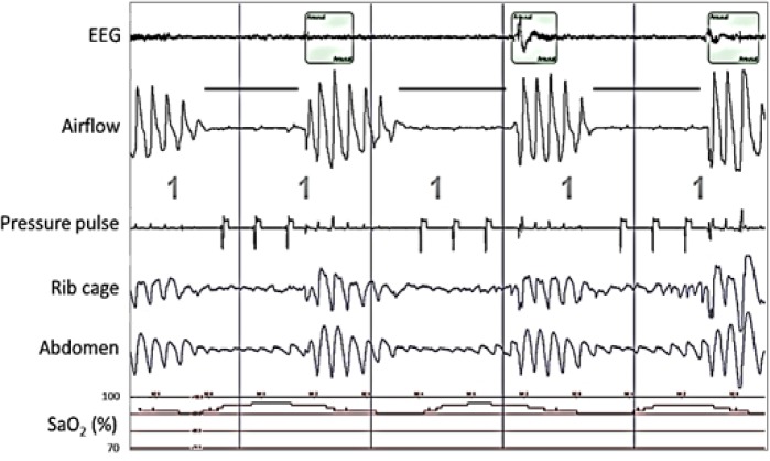 Figure 5