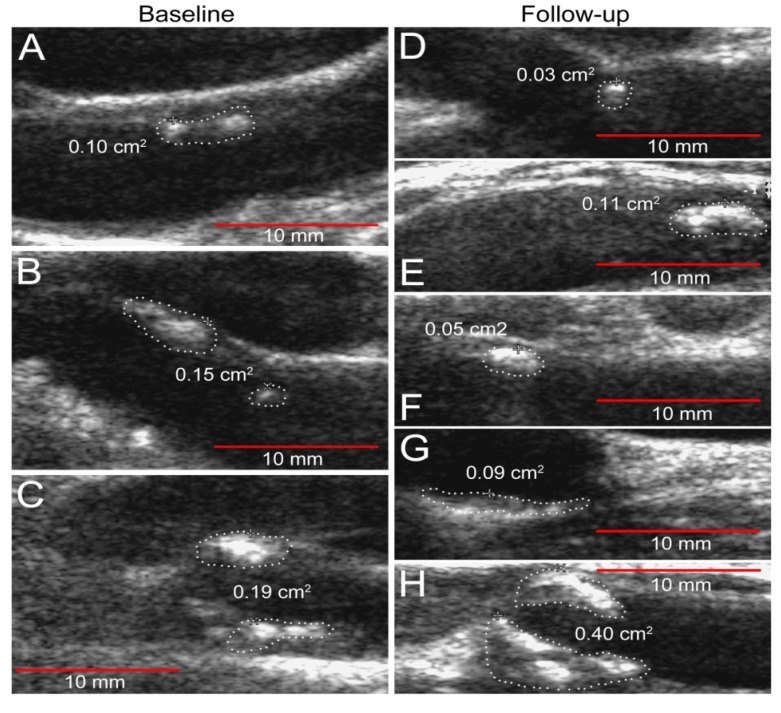 Fig. (1)