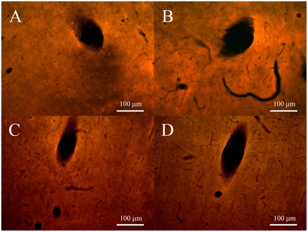 Figure 11