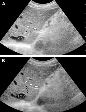 Fig. 6