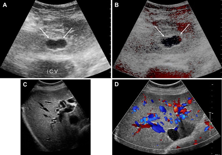 Fig. 11