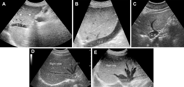 Fig. 10