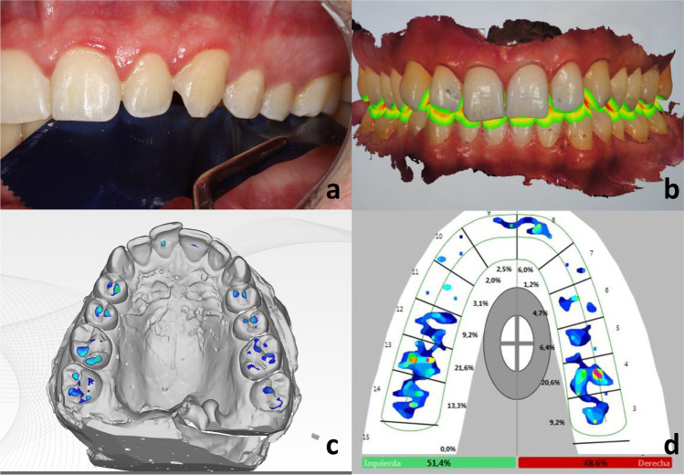 Fig. 1