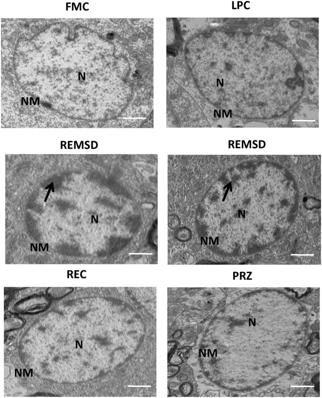 Figure 13