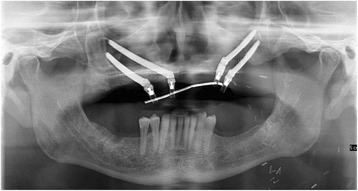 Fig. 13